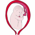 La présentation par le siège. Dans la présentation par le siège, bébé se présente les fesses les premières. Une présentation par le siège simple