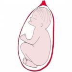 La présentation la face. Bébé se présente bien par la tête, mais la face en avant. Bébé présente la partie la plus large de sa tête. Cette présenta
