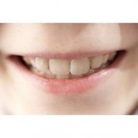 Les dents