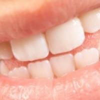 Dents de lait