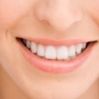 Belle dentition