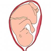 La présentation de bébé par la tête. La présentation habituelle du bébé est une présentation par la tête. Le bébé se présente
