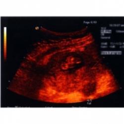 La 3eme Echographie De Votre Bebe Sur Tete A Modeler