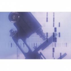 Diagnostic de la trisomie 21