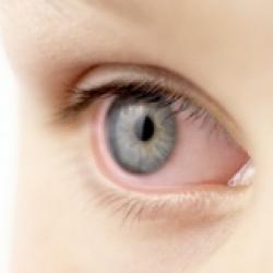 L'humeur aqueuse de l'oeil
