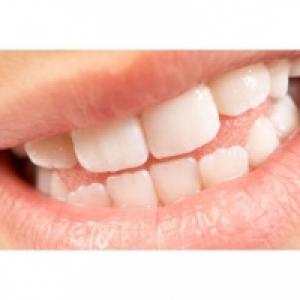 Les dents, la dentition