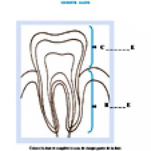 Activité sur la couronne et la racine de la dent - Planche anatomique