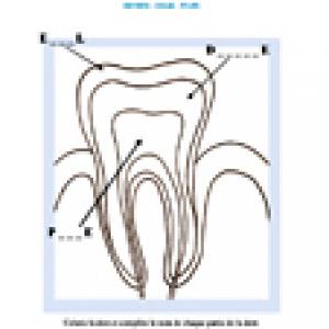 Activité sur la dentine, l'émail et la pulpe 